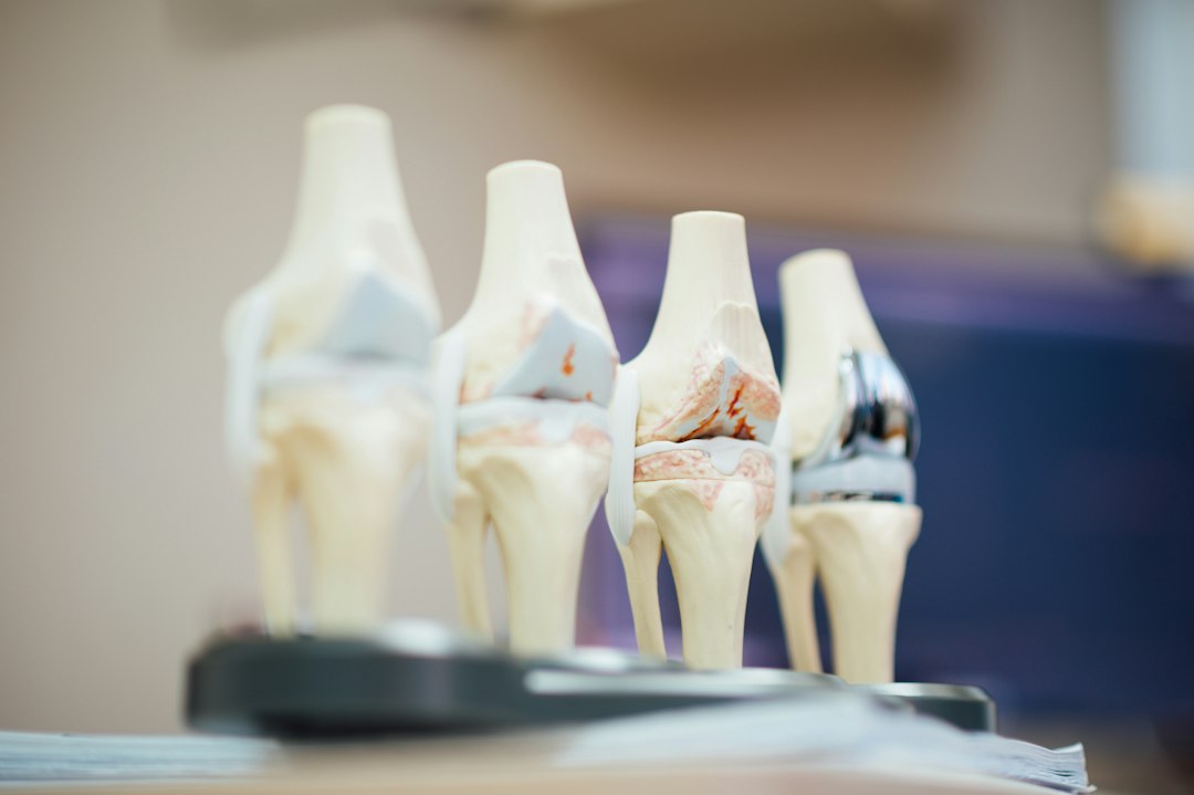 Why Joint Cartilage Deteriorates With Age (And How to Slow It Down)